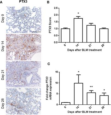 Endogenous Long Pentraxin 3 Exerts a Protective Role in a Murine Model of Pulmonary Fibrosis